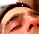 Acupunctuur: werkzame behandeling of krachtige placebo?